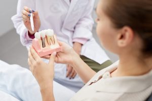 dantų implantavimas Vilniuje
