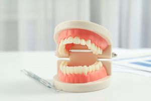 momentinė dantų implantacija